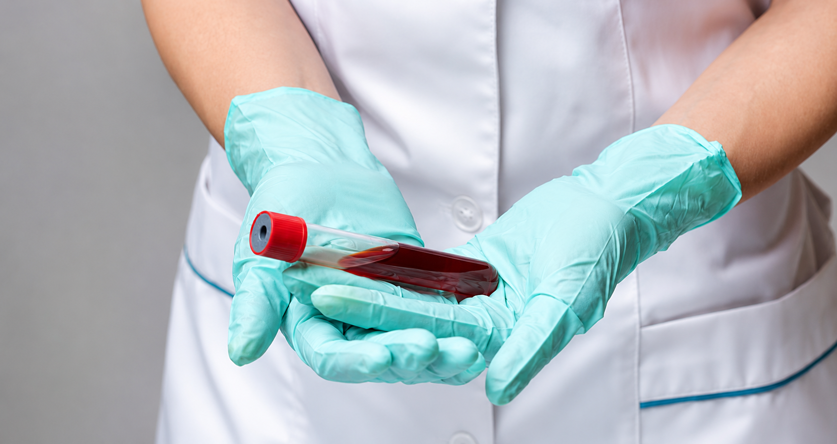 Coleta de sangue para exame de soro amilóide em felinos em hospital veterinário de São Bernardo do Campo.